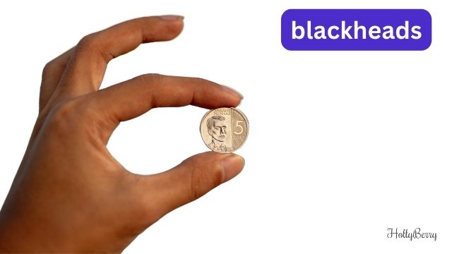 blackheads with a coin tiktok trents