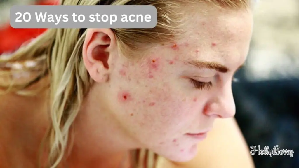 20 Ways to stop acne
