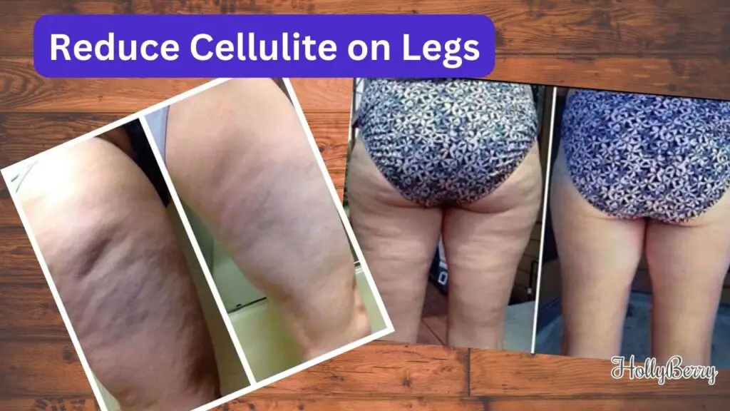 Reduce Cellulite on Legs