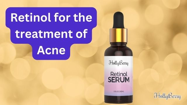 Retinol for the treatment of Acne