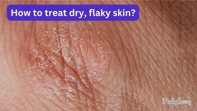 treat dry, flaky skin?