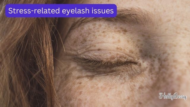 stress-related eyelash issues