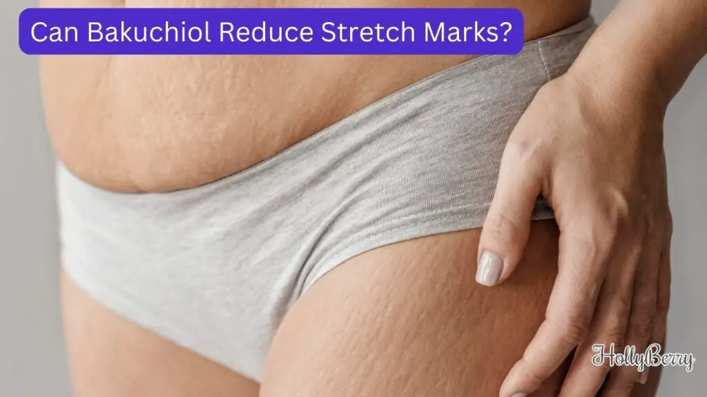 Can Bakuchiol Reduce Stretch Marks